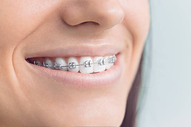 Best Veneers and Lumineers  in Morrisville, VT